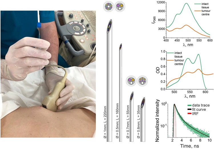 фото: Учёные ОГУ имени И.С. Тургенева разработали технологию оптической биопсии  для мгновенного распознавания рака